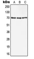 IHC-plus™ CD105 Antibody (Internal)