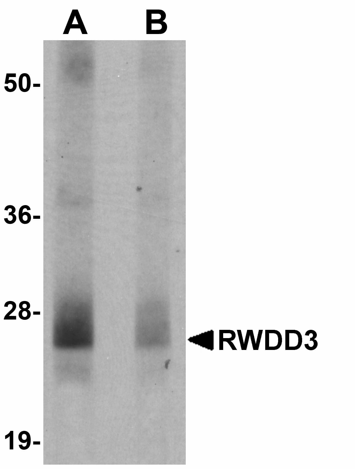 IHC-plus™ RWDD3 Antibody