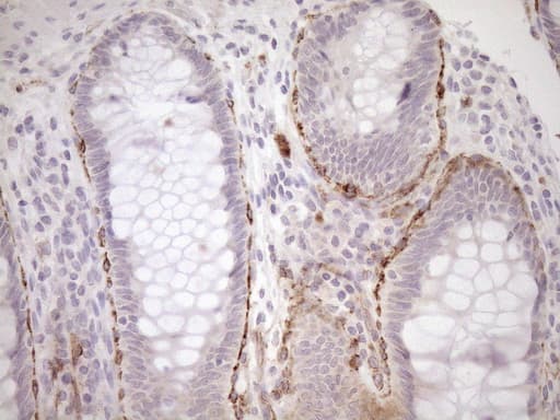 Monoclonal Mouse anti-Human BLNK Antibody (clone OTI4C9, aa1-292, IHC, WB)
