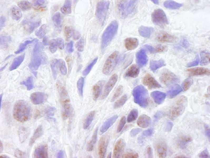 CREBBP / CREB Binding Protein Antibody (aa2375-2425)