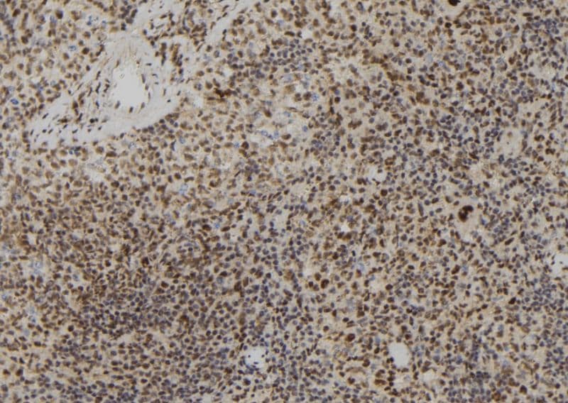 LMNB2 / Lamin B2 Antibody