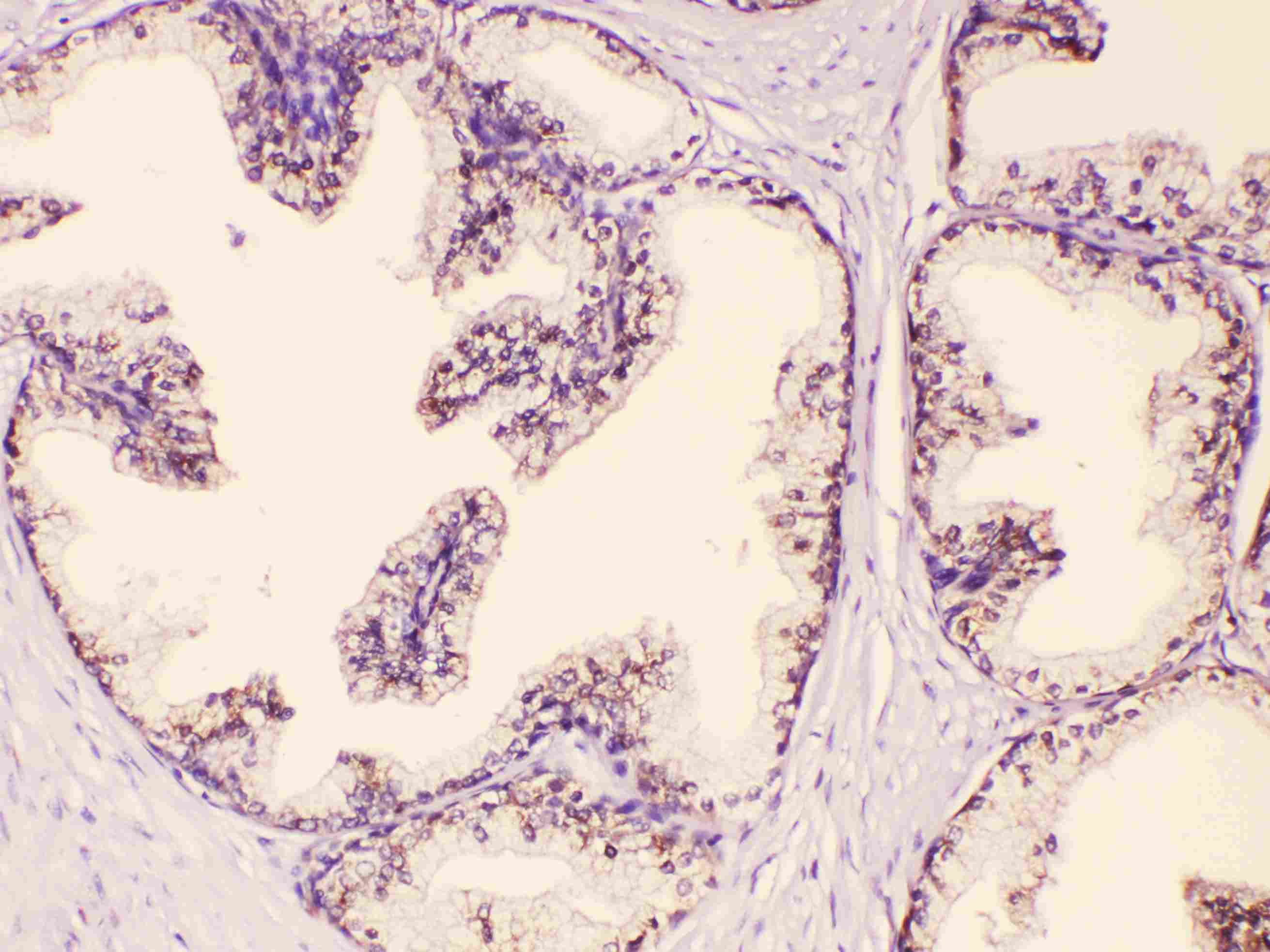 GAA / Alpha-Glucosidase, Acid Antibody