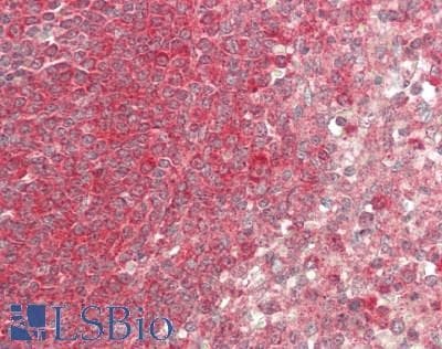 IHC-plus™ Polyclonal Rabbit anti-Human NEDD4 Antibody (IHC, WB)