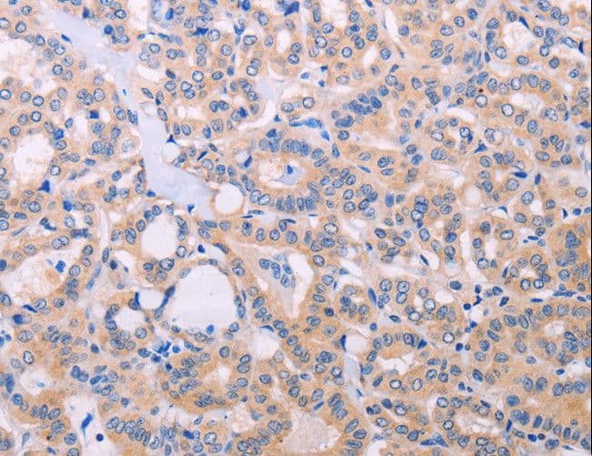 ADCY5 / Adenylate Cyclase 5 Antibody