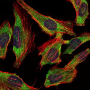 Monoclonal Mouse anti-Human NF-L / NEFL Antibody (clone 2G10, IHC, IF, WB)
