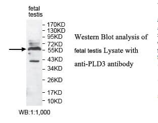 PLD3 / Phospholipase D3 Antibody (aa162-439)