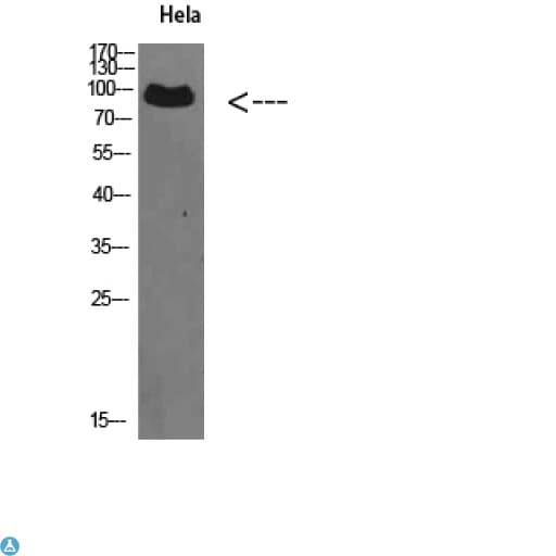 Polyclonal Rabbit anti-Human VPS35 Antibody (WB)
