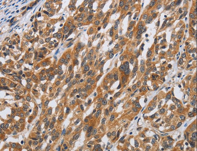 Polyclonal Rabbit anti-Human DSP / Desmoplakin Antibody (IHC)