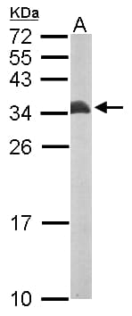 ETFB Antibody (aa1-255)