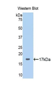 RPN1 / Ribophorin I Antibody (aa308-438)