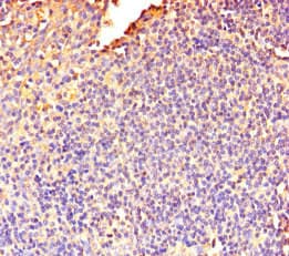 DOK5 Antibody