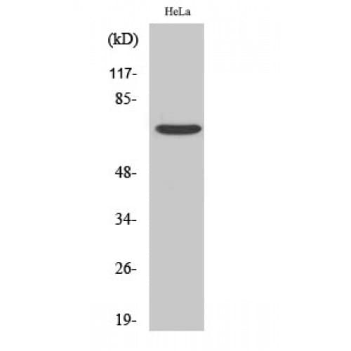 FZD1 / Frizzled 1 Antibody (30-110 aa, N-terminal)