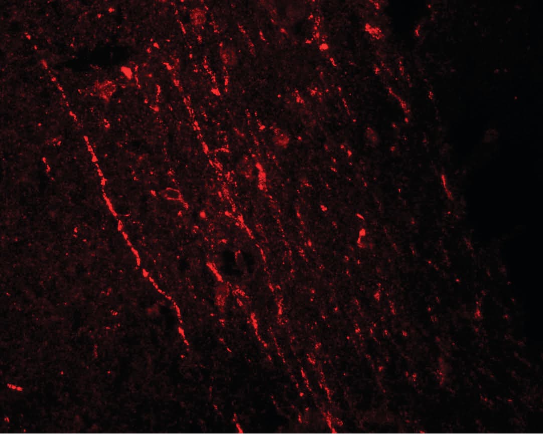 FGFR3 Antibody