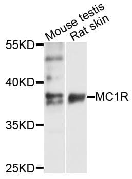 MC1R Antibody