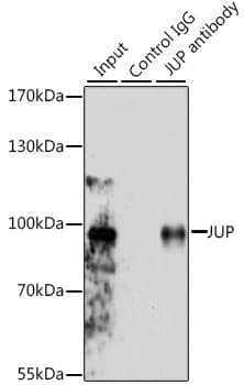 Polyclonal Rabbit anti-Human JUP/CTNNG/Junction Plakoglobin Antibody (IHC, IF, WB)