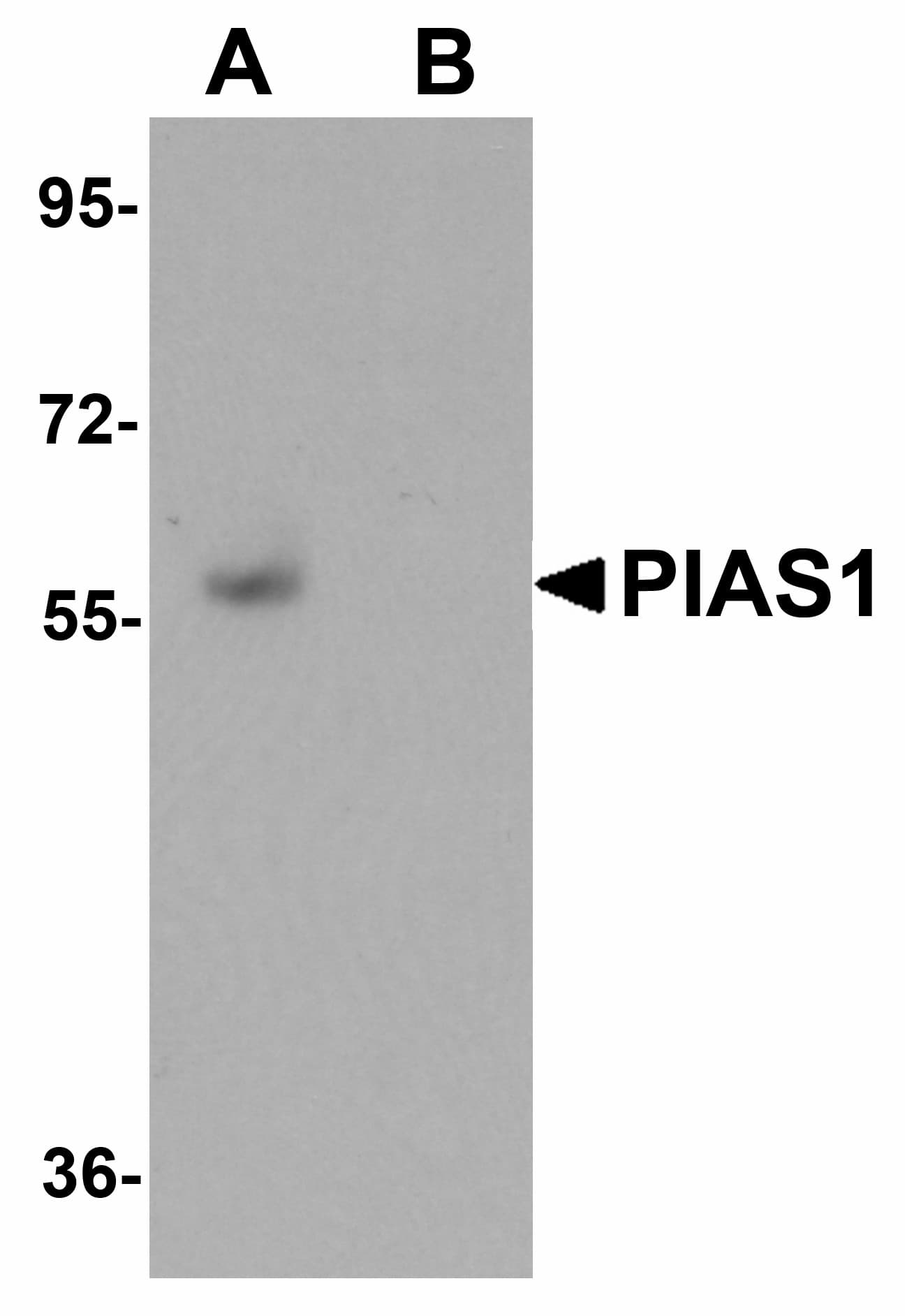 IHC-plus™ PIAS1 Antibody