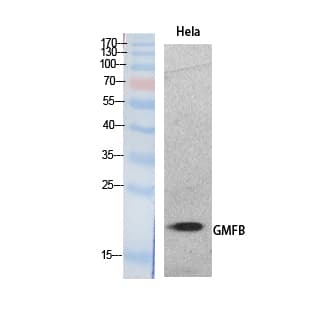 GMF Beta / GMFB Antibody