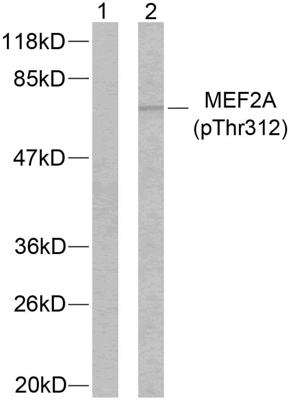 MEF2A / MEF2 Antibody (phospho-Thr312)