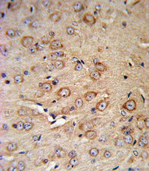 Polyclonal Rabbit anti-Human CRHR2 / CRF2 Receptor Antibody (aa84-114, IHC, WB)