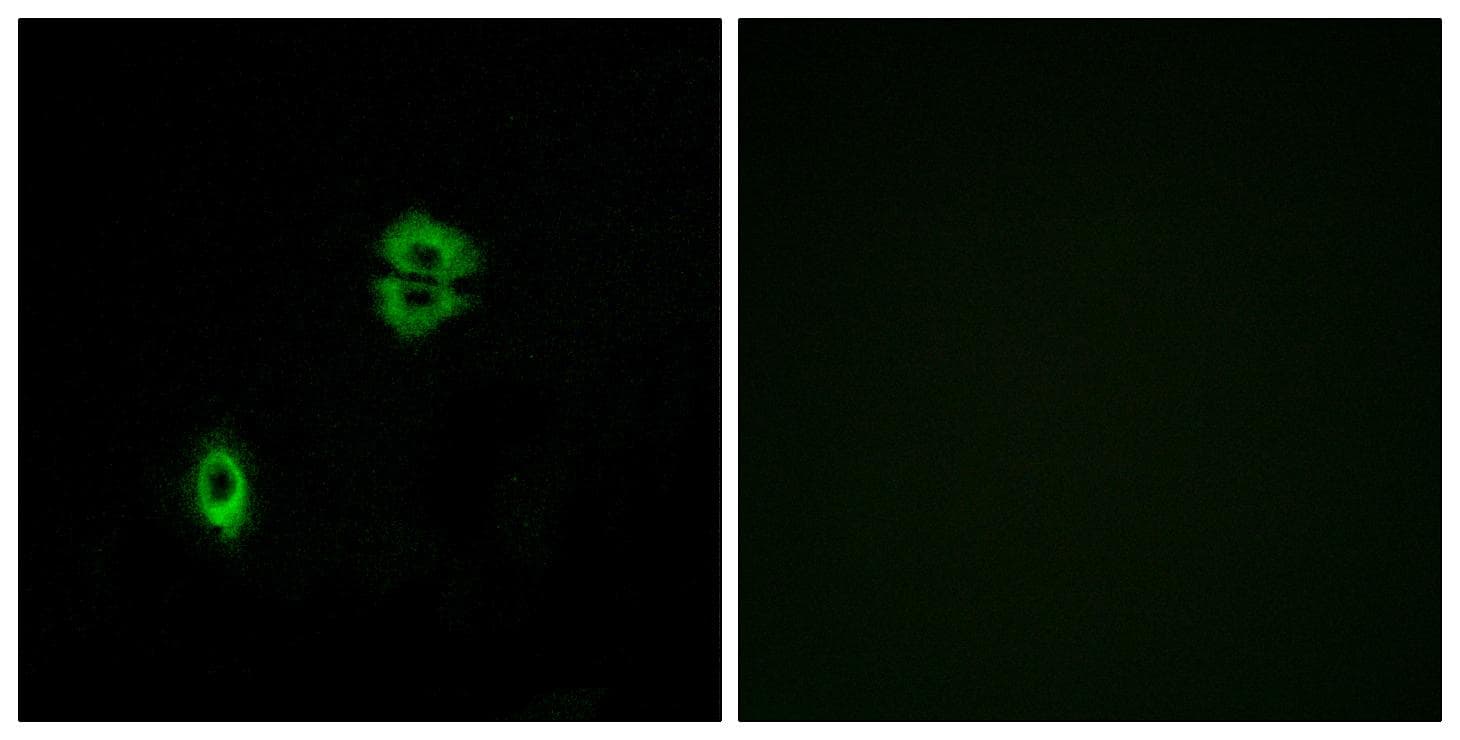 CCR7 Antibody