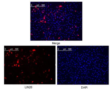 LIN28A / LIN28 Antibody (clone 6D1F9)