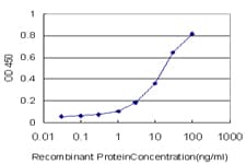 GRID2 Antibody (clone 1A1)