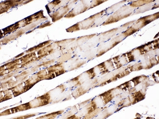 Polyclonal Rabbit anti-Human CA3 / Carbonic Anhydrase III Antibody (IHC, WB)