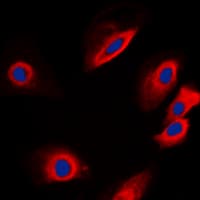 PTP1B Antibody (N-Terminus)