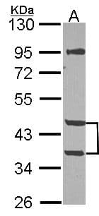 Mannose Phosphate Isomerase Antibody (aa1-154)