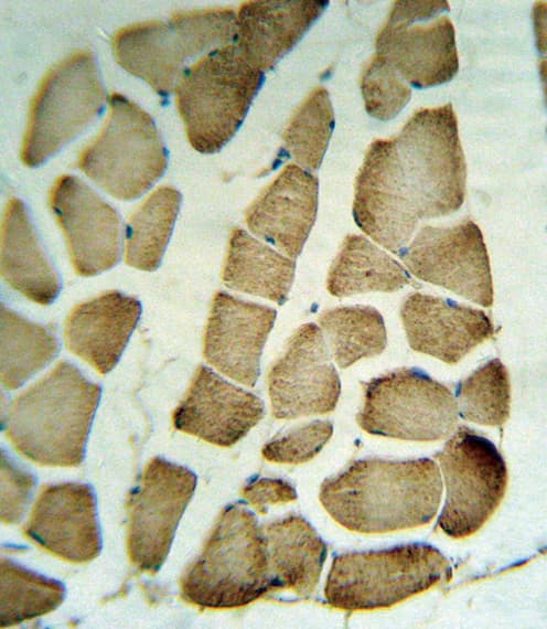 PARVA Antibody (aa323-351)
