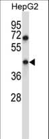 TMEM49 Antibody (aa377-406)