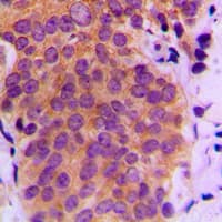 MAP2K4 / MKK4 Antibody (phospho-Ser80)