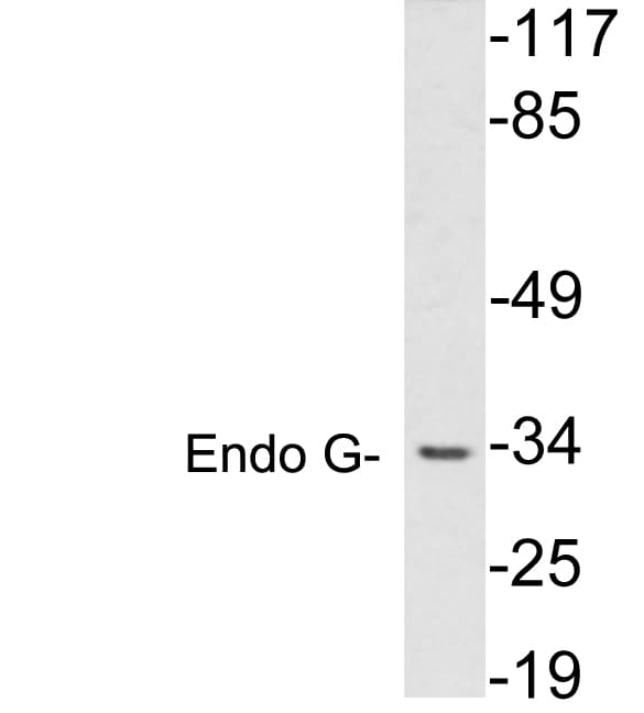 Polyclonal Rabbit anti-Human Endonuclease G / ENDOG Antibody (aa61-110, WB)