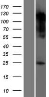 AANAT Protein (Over-Expression Lysate Myc-DDK (Flag))