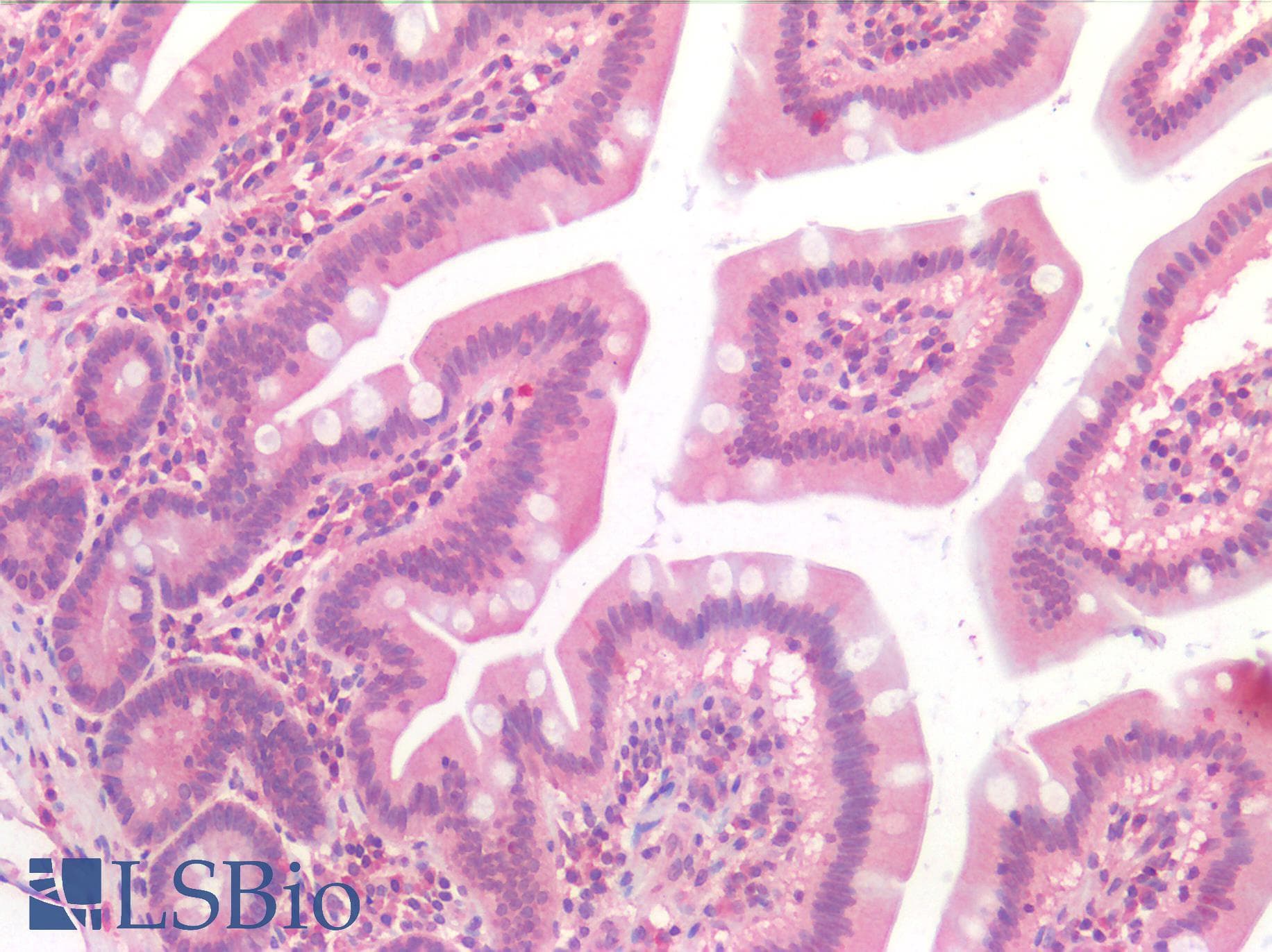 IHC-plus™ Polyclonal Rabbit anti-Human FOLH1 / PSMA Antibody (IHC)