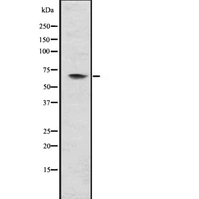 MMP21 Antibody