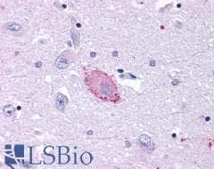PathPlus™ GRM3 / MGLUR3 Antibody (N-Terminus)