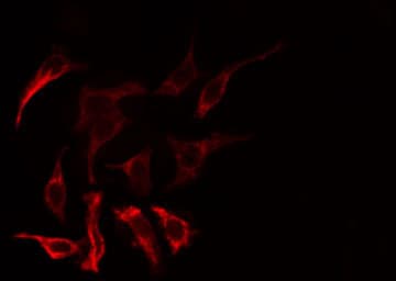 GNAT1 Antibody
