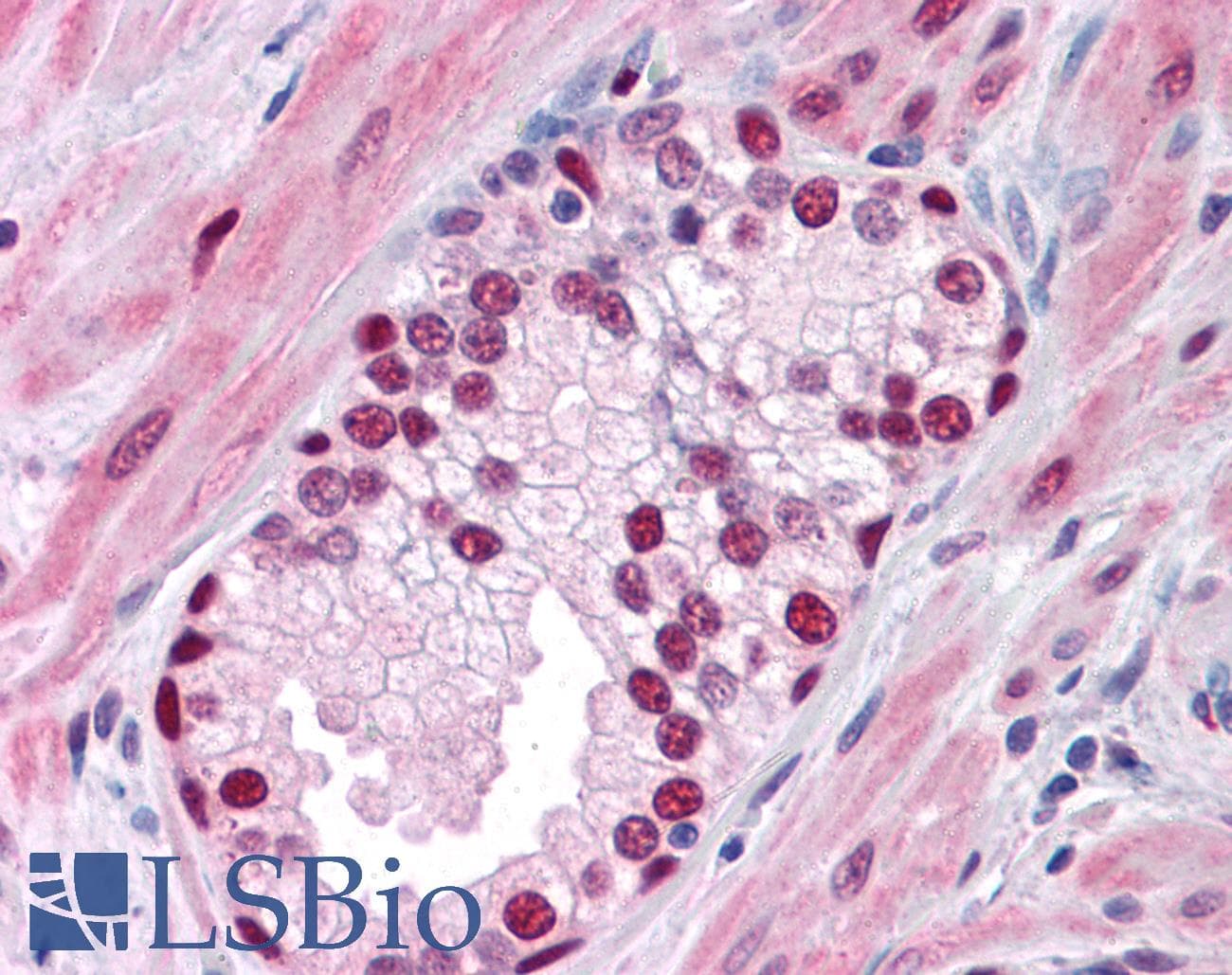 IHC-plus™ SOX9 Antibody (clone 3C10)