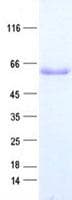 Human TBL1X / TBL1 Protein (Recombinant His, N-Terminal)