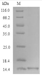 Mouse OCM / Oncomodulin Protein (Recombinant 6His, N-terminus)