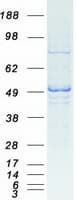 Human ARMT1 Protein (Recombinant Myc-DDK (Flag))