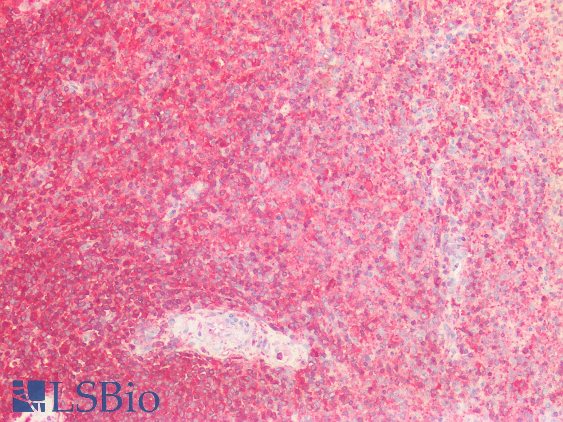 IHC-plus™ Polyclonal Rabbit anti-Human OPRL1 / ORL1 Antibody (IHC, WB)