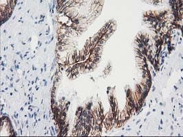 VCAM1 / CD106 Antibody (clone OTI3H10, Carrier-free)