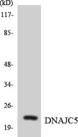Polyclonal Rabbit anti-Human DNAJC5 / CSP Antibody (aa122-171, WB)