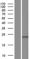 TLCD1 Protein (Over-Expression Lysate Myc-DDK (Flag))