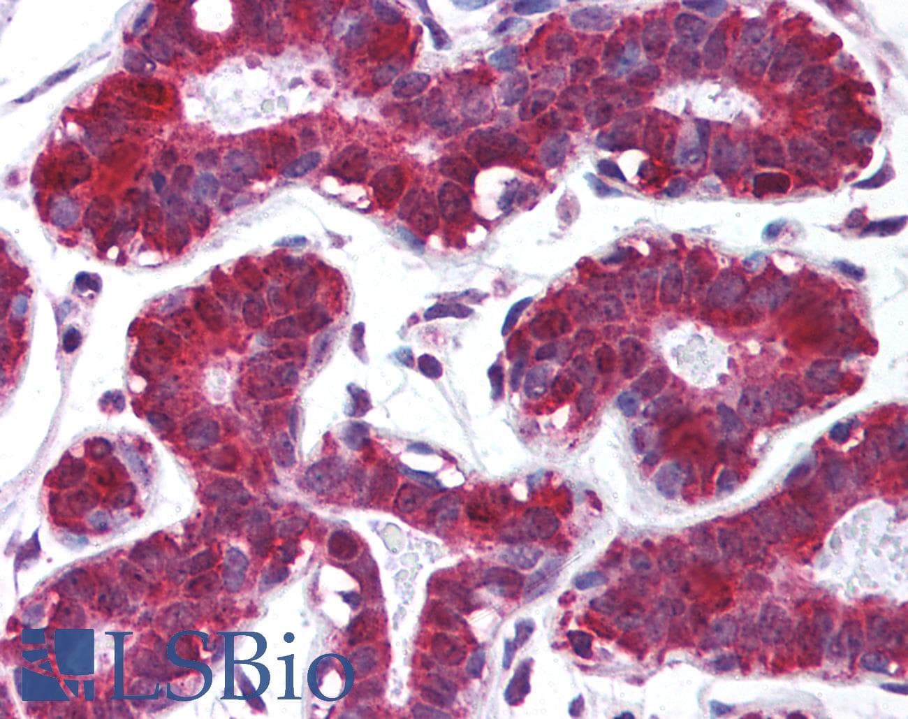 PathPlus™ Polyclonal Rabbit anti-Human PDCD4 Antibody (IHC, WB)