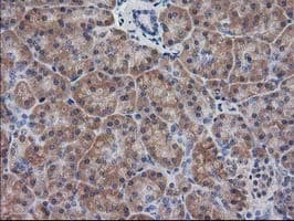 DSTN / Destrin Antibody (clone OTI1D8)