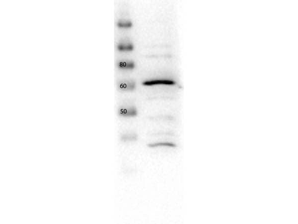 SLC2A2 / GLUT2 Antibody (C-Terminus)