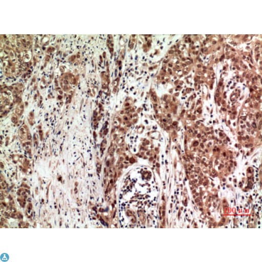 ZFPM2 / FOG2 Antibody